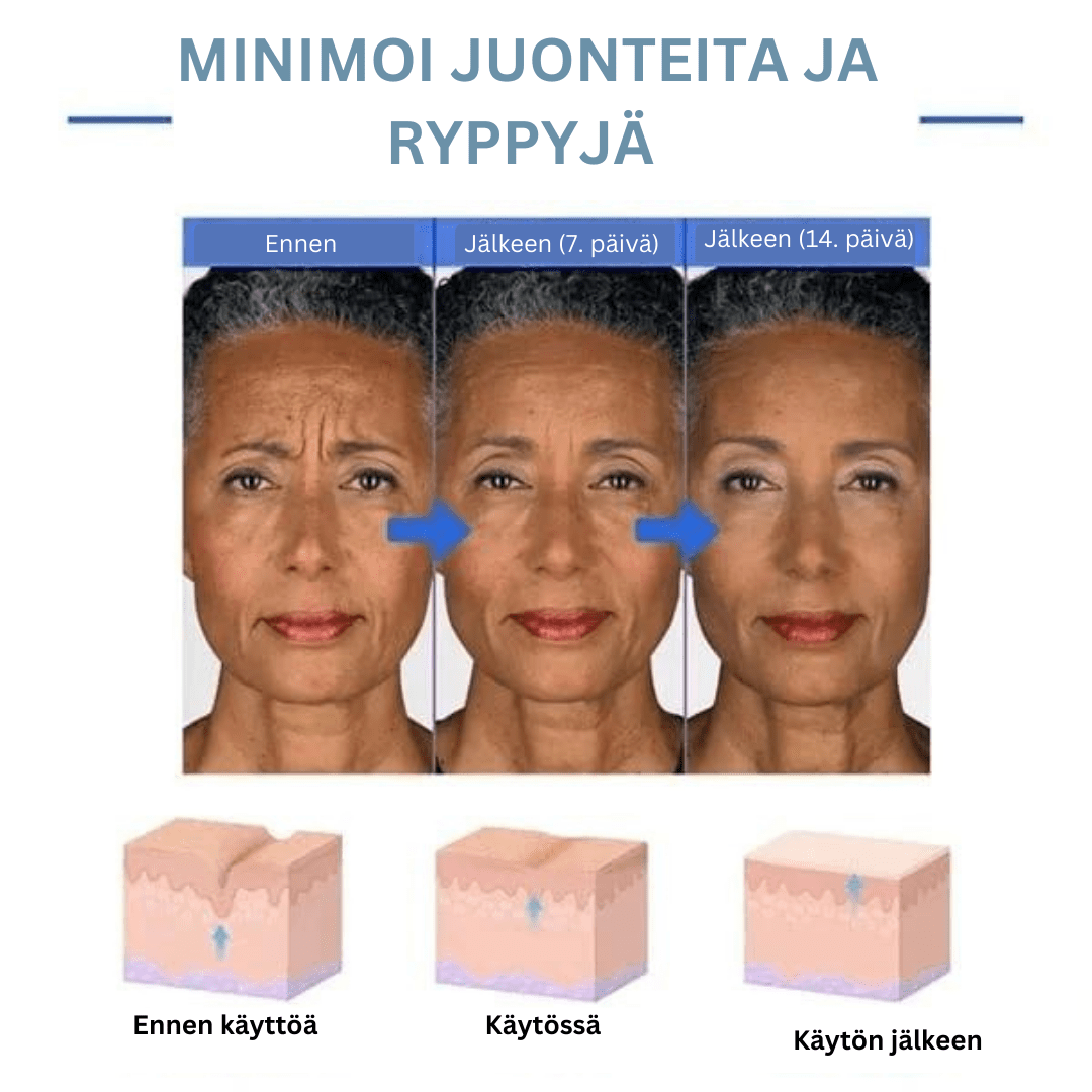 Martalvo ™ | Botox kasvoseerumi