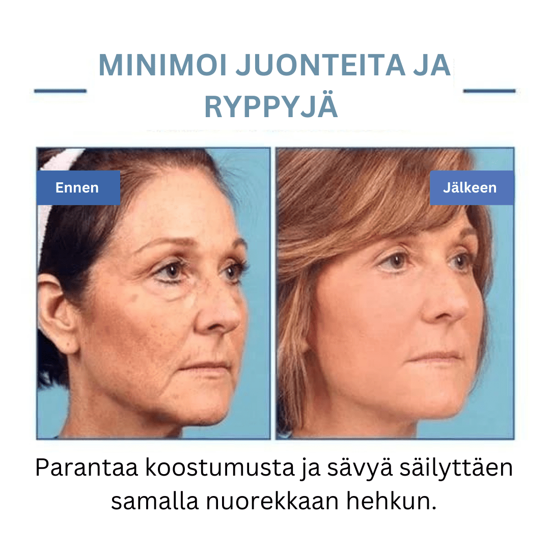 Martalvo ™ | Botox kasvoseerumi