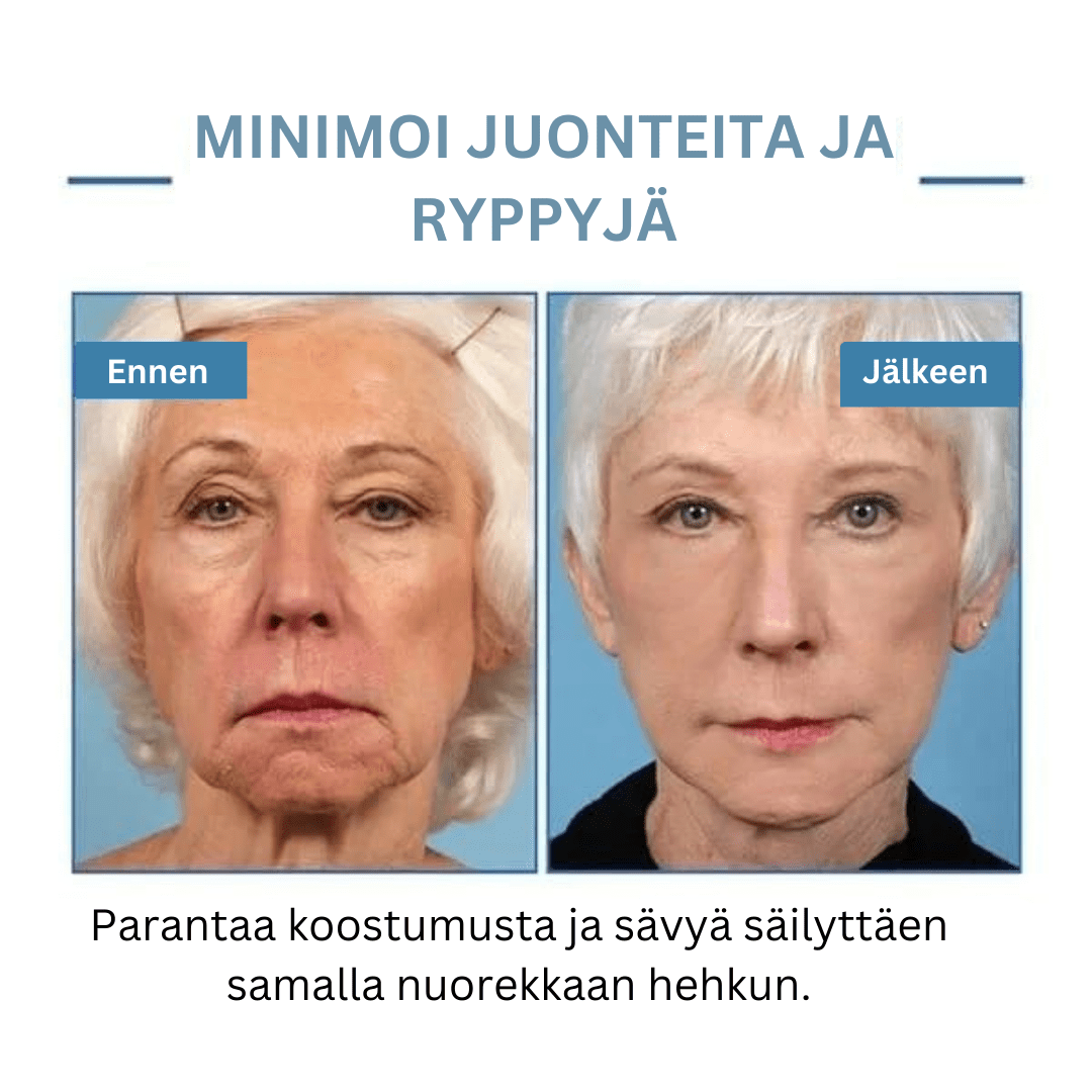 Martalvo ™ | Botox kasvoseerumi